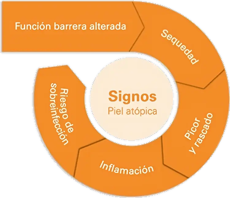 piel dermatitis atopica agua dura