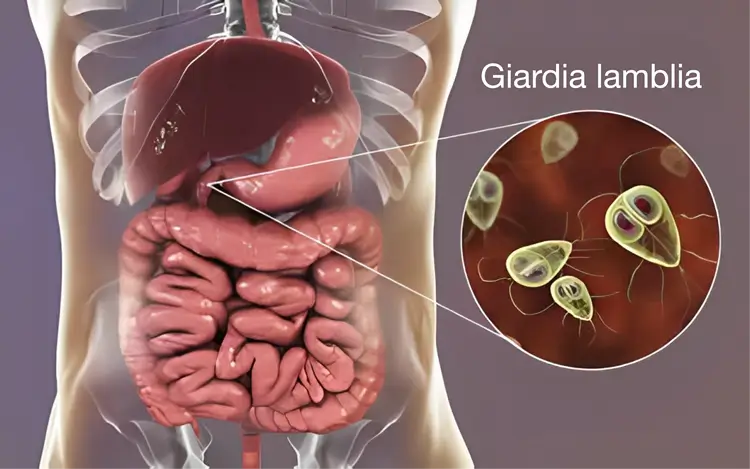Giardia tratamiento ultravioleta